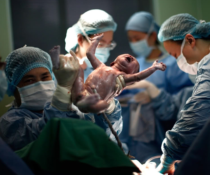 Küba Tıp Aids Bebek